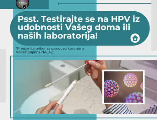 NOVA mogućnost u laboratorijama Nalaz